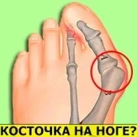 Узі матки і придатків у жінок як робиться, підготовка, що показує (підготовка) Узі матки і придатків у жінок як робиться, підготовка, що показує