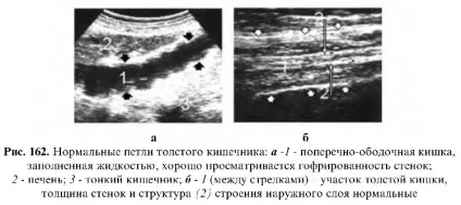 Узі шлунково-кишкового тракту (тракту) Узі шлунково-кишкового тракту