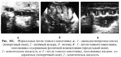 Узі шлунково-кишкового тракту (шлунково-кишкового) Узі шлунково-кишкового тракту