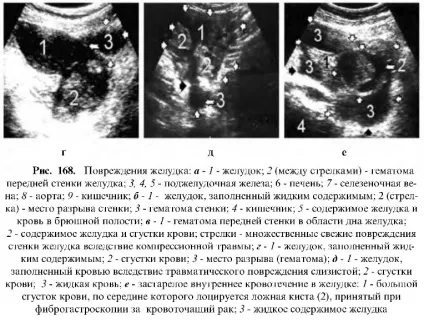 Узі шлунково-кишкового тракту (шлунково-кишкового) Узі шлунково-кишкового тракту