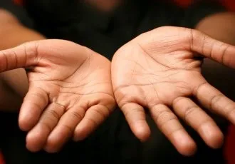 Все про тріщини і лущення шкіри (Причини лікування лущення) Все про тріщини і лущення шкіри