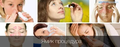 ЯМІК процедура при гаймориті, симптоми і лікування (симптоми) ЯМІК процедура при гаймориті, симптоми і лікування