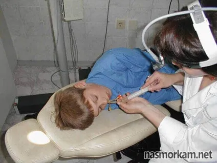 ЯМІК процедура при гаймориті