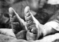 47 шокуючих знімків ніг китайських «жінок-лотосів» (китайських) 47 шокуючих знімків ніг китайських «жінок-лотосів»