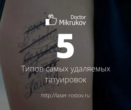5 Типів самих видаляються татуювань