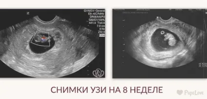 8 Тиждень вагітності - фото живота, розмір плоду, харчування та поради (живота) 8 Тиждень вагітності - фото живота, розмір плоду, харчування та поради