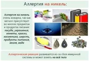 Алергія на нікель - що є, яких продуктів слід уникати - «все до дрібниць» (продуктів) Алергія на нікель - що є, яких продуктів слід уникати - «все до дрібниць»