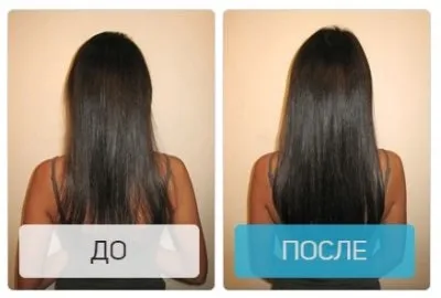 Активатори росту волосся принцип дії, огляд популярних марок і рецепти приготування в домашніх (волосся) Активатори росту волосся принцип дії, огляд популярних марок і рецепти приготування в домашніх