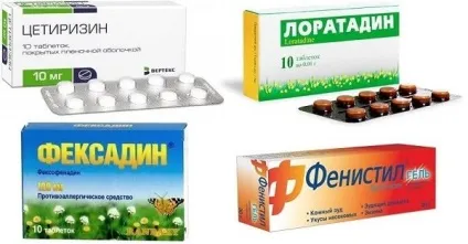 Алергія на укуси постільних клопів як виглядають і як лікувати (фото)