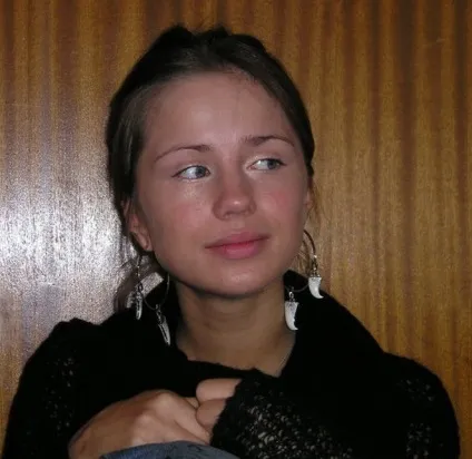 Алекса контурна пластика губ і ринопластика співачки, фото до і після (алекса до і після ринопластики) Алекса контурна пластика губ і ринопластика співачки, фото до і після