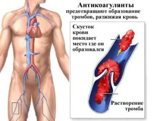 Антикоагулянти що це таке і список препаратів (антикоагулянти) Антикоагулянти що це таке і список препаратів
