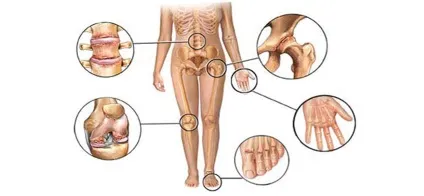 Артрологія, meddoc