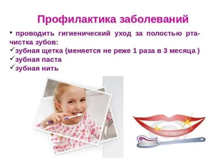 Хвороба ясен - симптоми і лікування - гінгівіт, пародонтит, стоматит (хвороба) Хвороба ясен - симптоми і лікування - гінгівіт, пародонтит, стоматит