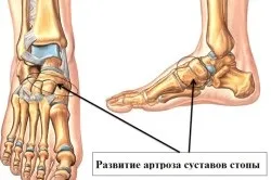 Біль в суглобі стопи причини і лікування (здорові стопи) Біль в суглобі стопи причини і лікування