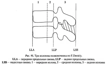 Біль у спині між лопатками причини, симптоми, лікування патології