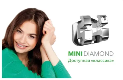 Брекети mini diamond конструктивні особливості, установка і термін носіння (металеві) Брекети mini diamond конструктивні особливості, установка і термін носіння
