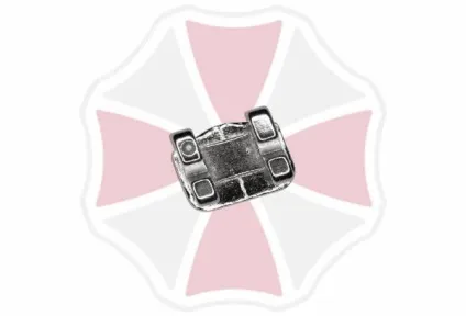 Брекети mini diamond конструктивні особливості, установка і термін носіння (mini) Брекети mini diamond конструктивні особливості, установка і термін носіння