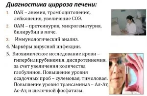 Чим лікувати цироз печінки препарати, знеболюючі ліки, таблетки (препарати) Чим лікувати цироз печінки препарати, знеболюючі ліки, таблетки