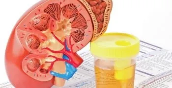 Що таке інфаркт легкого - причини і наслідки, симптоми і лікування (таке) Що таке інфаркт легкого - причини і наслідки, симптоми і лікування