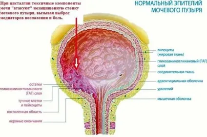 Цисталгія у жінок причини, симптоми і лікування міхура неврозу (причини) Цисталгія у жінок причини, симптоми і лікування міхура неврозу
