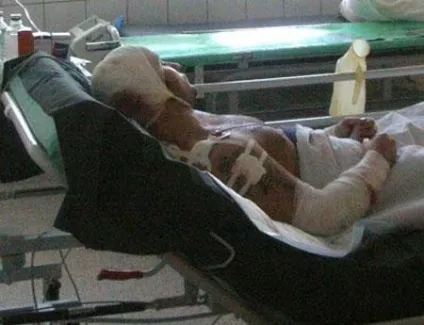 Циркові трагедії як звірі калічать дресирувальників - джерело гарного настрою (цирку) Циркові трагедії як звірі калічать дресирувальників - джерело гарного настрою