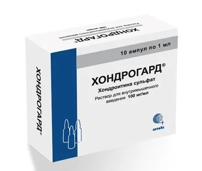 Деформуючий артроз гомілковостопного суглоба (гомілковостопного) Деформуючий артроз гомілковостопного суглоба