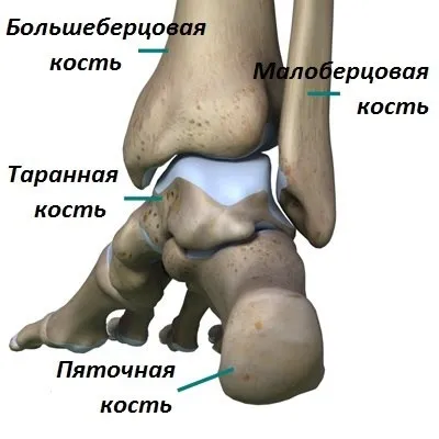 Деформуючий артроз гомілковостопного суглоба (деформуючий) Деформуючий артроз гомілковостопного суглоба