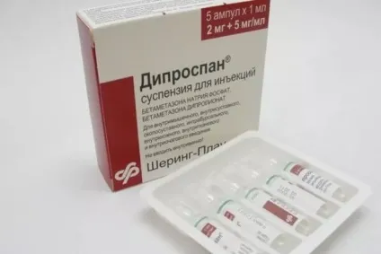 Деформуючий артроз гомілковостопного суглоба - причини, симптоми і лікування (гомілковостопного) Деформуючий артроз гомілковостопного суглоба - причини, симптоми і лікування