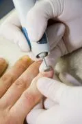 Ефективне і сучасне лікування грибка нігтів полягає в комплексному підході