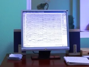 ЕЕГ з депривації сну