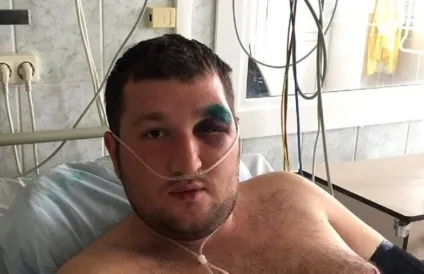 Два жителя бреста звернулися до слідчого комітету зі скаргою на побої міліціонерів (слідчий) Два жителя бреста звернулися до слідчого комітету зі скаргою на побої міліціонерів