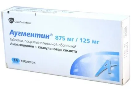 Ефективні ліки від трахеїту, інгаляції (дуже докладно розповідається) Ефективні ліки від трахеїту, інгаляції