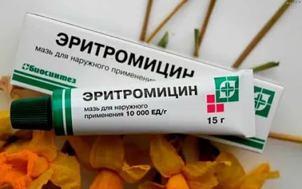 Ерітроміціновая мазь від прищів, інструкція і показання для шкіри (прищів) Ерітроміціновая мазь від прищів, інструкція і показання для шкіри