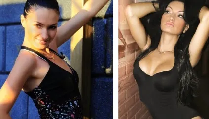 Євгенія Феофілактова (Гусєва) - фото до і після пластики (Феофилактова) Євгенія Феофілактова (Гусєва) - фото до і після пластики