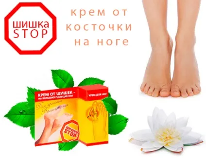 Шишка stop - крем від кісточки на нозі (крем) Шишка stop - крем від кісточки на нозі