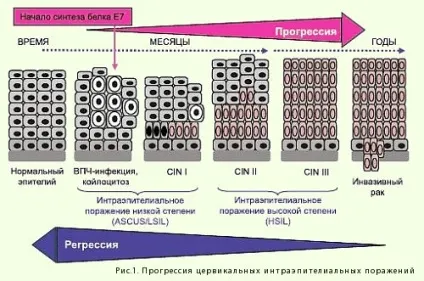 Гормони викликають ерозію шийки матки, Харків (ерозію) Гормони викликають ерозію шийки матки, Харків