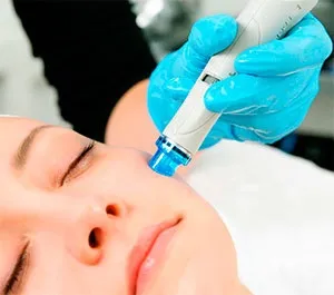 Hydrafacial - чистка особи