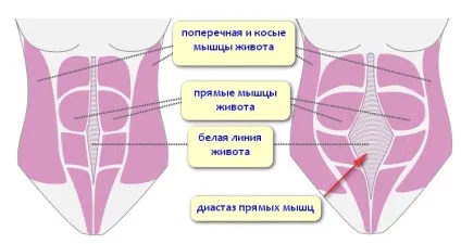 Грижі живота причини, види