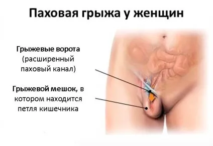 Грижі живота причини, види