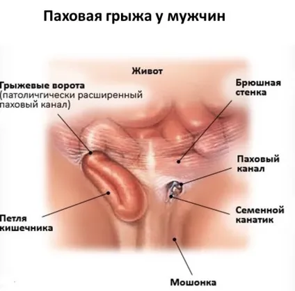 Грижі живота причини, види