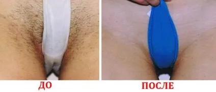 Як часто робити шугарінг бікіні, ніг, обличчя і пахв (більш тривалий результат) Як часто робити шугарінг бікіні, ніг, обличчя і пахв