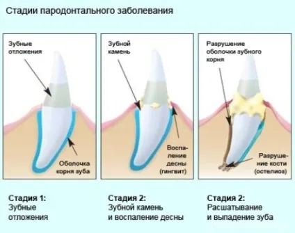 Як чистити зуби йоркширському тер'єрові, йоркширський тер'єр (зуби) Як чистити зуби йоркширському тер'єрові, йоркширський тер'єр