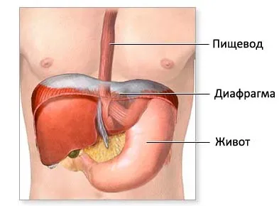 Симптоми і лікування грижі шлунка