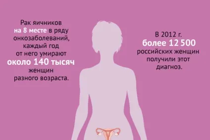 Симптоми і причини виникнення кісти на яєчниках у жінок, де знаходяться яєчники, чим небезпечна (кісти) Симптоми і причини виникнення кісти на яєчниках у жінок, де знаходяться яєчники, чим небезпечна