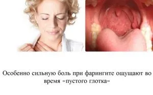 Як і чим лікувати біль в горлі при ковтанні (біль) Як і чим лікувати біль в горлі при ковтанні