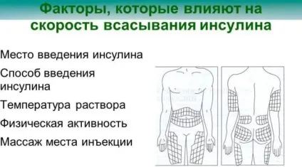 Які гормони регулюють рівень глюкози в крові (гормони) Які гормони регулюють рівень глюкози в крові