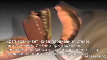 Як позбутися від дружини (дружини) Як позбутися від дружини