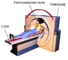 Як допомагає комп'ютерна томографія в діагностиці хвороб хребта