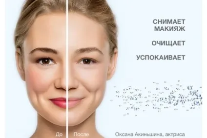 Як користуватися міцелярної водою чи потрібно змивати засіб з особи, як правильно використовувати (водою) Як користуватися міцелярної водою чи потрібно змивати засіб з особи, як правильно використовувати