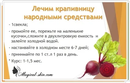 Кропив'янка на руках і пальцях причини, симптоми і лікування у дорослих (кропив'янка рука фото причина симптом лікування дорослий палець лікоть долоню нога кисть) Кропив'янка на руках і пальцях причини, симптоми і лікування у дорослих